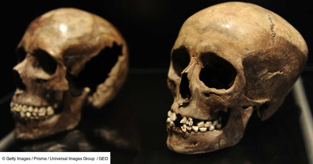 Prehistoric Humans Had Fewer Cavities