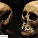 Prehistoric Humans Had Fewer Cavities