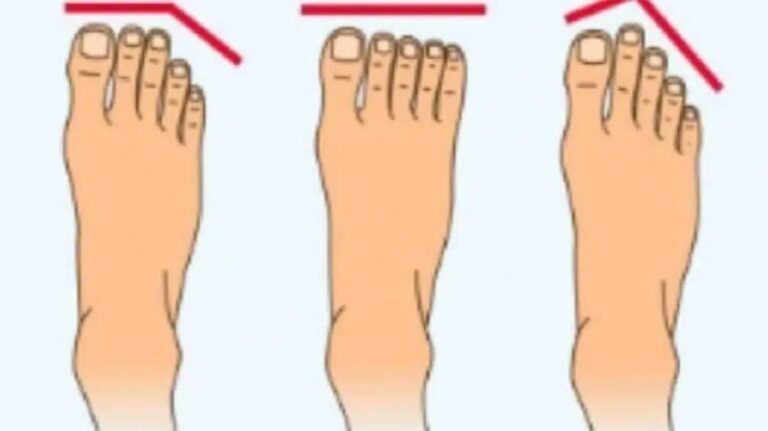Foot shape test